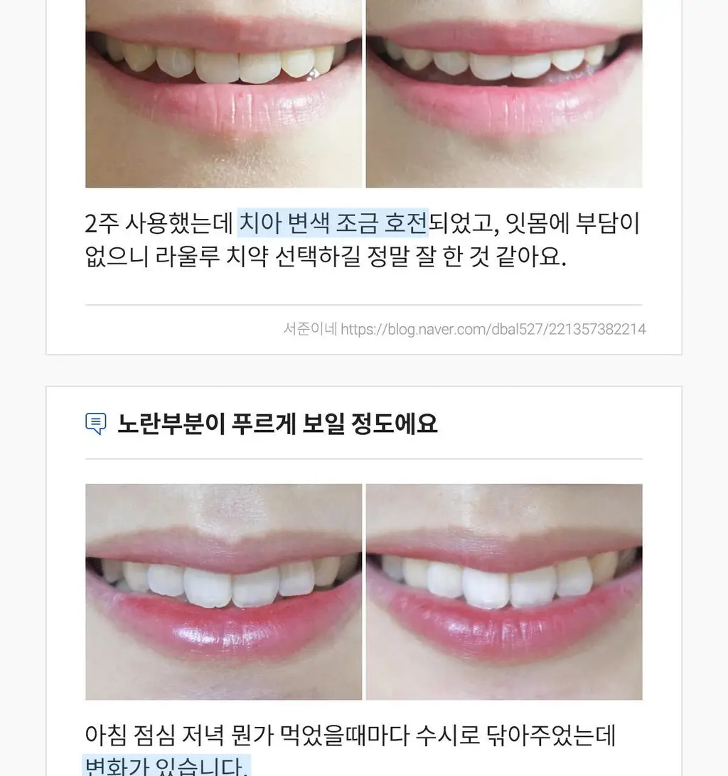 [무불소] 라울루 화이트 솔루션 플러스투 치약 100g 상세페이지 8